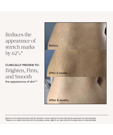 Evereden Golden Belly Serum 1.7 fl oz | Clean Body Care for Pregnancy & Postpartum | Natural Plant-Based Maternity Skincare | Non-Toxic Belly Oil - Buy Online on GoSupps.com