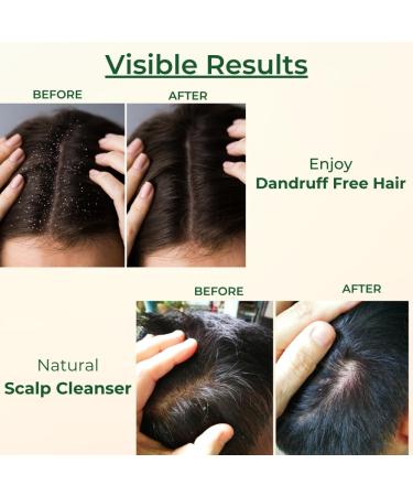 CULTIVATOR S Herbal Hair Dry Shampoo - Amla & Charcoal Powder 8.81Oz | Natural Anti-Dandruff Organic Treatment for Dry & Itchy Scalp - Buy Online on GoSupps.com