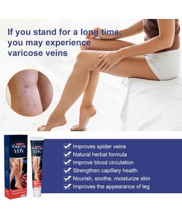 Cr me Contre Les Varices Cr me Pour Les Varices R paration Des Jambes D'Araign e Convient Tous Les Types De Peau apaise et hydrate rapidement - Buy Online on GoSupps.com