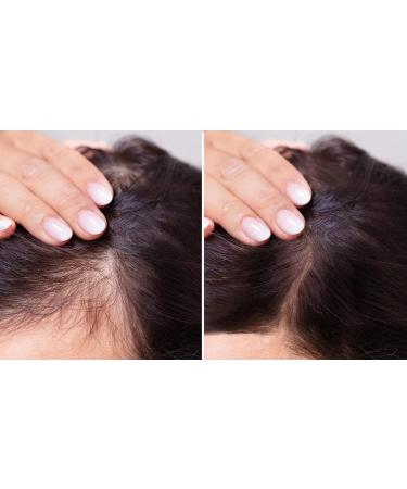  Herbaria Herbaria Banfi Nettle Shampoo for Normal Hair Moisturizing Herbal 250 ml Csalan Shampoo for Normal Hair Hajra - Buy Online on GoSupps.com