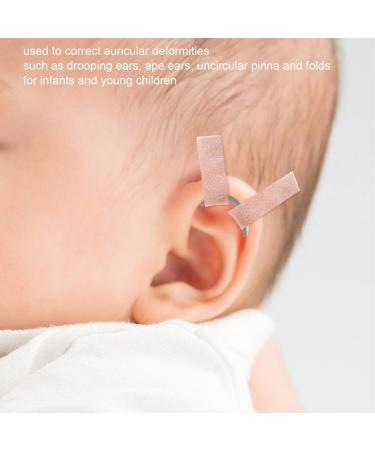 Gel Ear Tape - Breathable & Skin-Friendly Ear Corrector for Newborns - Buy Online on GoSupps.com