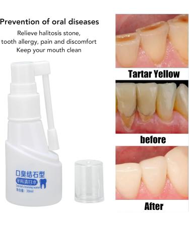 30ml Tooth Cleaning Spray - Bad Breath Relief Tartar Control & Allergy-Friendly | Freshen Up Your Smile - Buy Online on GoSupps.com
