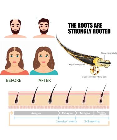 Serum Pousse Cheveux Growth Hair Oil S rum De Croissance Capillaire Acc l rer La Croissance Des Cheveux Pour Fortifier Et Favoriser La Densifie Hair nourrir Le Chevelu Pr venir Chute 50 ML - Buy Online on GoSupps.com