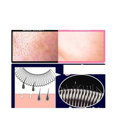 Iercza 2-Piece Manual Epilator Set | Jumping Face Hair Remover & Threading Tools for Effective Facial Hair Removal - Buy Online on GoSupps.com