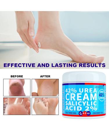ASDToTio Urea Cream 42% with Salicylic Acid | Tea Tree Oil | Shea Butter | Aloe Vera - 4 oz - Buy Online on GoSupps.com