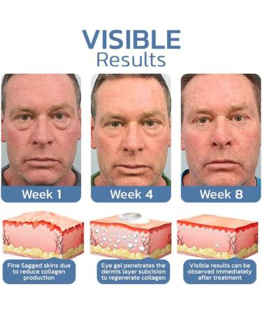  Mzshne Retinol eye cream for men. Relieves wrinkles. Solid skin cream for day and night beauty eye maintenance. - Buy Online on GoSupps.com