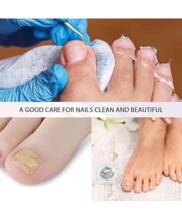 MFCGHXR Nail Care Toenail Correction Patch Set of 124 Includes Patch Nail Stickers File Lifter & Remover Black L - Buy Online on GoSupps.com