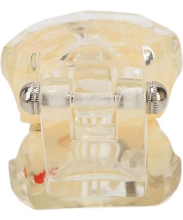Buy Verdant Touch Transparent Dental Implant Model - Ideal Teaching Aid for Pathology & Dental Studies | International Shipping Available - Buy Online on GoSupps.com