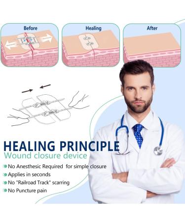 ArixMed Emergency Wound Closure Device - Zip Sutures Butterfly Bandaids - Quick Clot for Cuts & Tears - 2 Set (2 PCS) - Buy Online on GoSupps.com