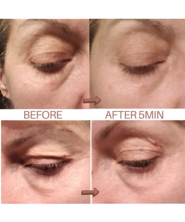 Instant Lifting Serum - Hydrating Face & Eye Contour with Hyaluronic Acid & Peptides - 15ml - Global Shipping Available - Buy Online on GoSupps.com