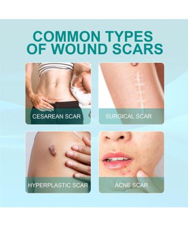 VOIV Scar Remover Spray 20g 5pcs - Relieves Itching, Removes Dark Acne - Dermatologist Recommended for All Types of Scars - Buy Online on GoSupps.com