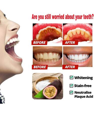 Intensive Stain Removal Whitening Toothpaste Bundle - Fresh Breath Oral Care with Baking Soda - Fight Bleeding Gums - Natural Gel Toothpaste - 2 Pack (Passion Fruit+Blueberry) - Buy Online on GoSupps.com
