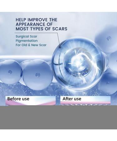 Anti-Scar Cream 20g Skin Repair | Face & Body Scar Removal | Lavender Healing Cream To Promote Natural Healing - Buy Online on GoSupps.com