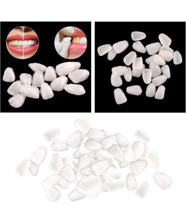 Facettes temporaires ultra-minces en r sine blanchissant de type mixte blanc pour la protection de la beaut dentaire - Buy Online on GoSupps.com