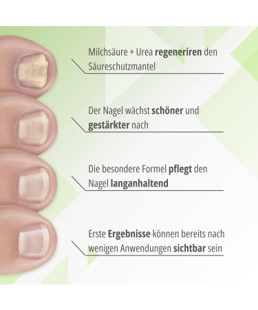 NCP MyNail Nail Treatment 10ml - Effective Care Serum for Nail Fungus & Healthy Shiny Nails - International Shipping Available - Buy Online on GoSupps.com