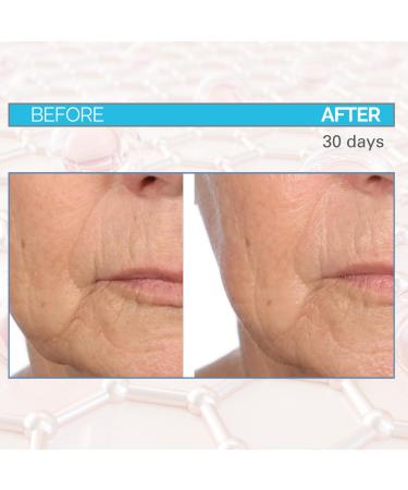 Dr. Mark Pinsky Trace + Erase Wrinkle Filler Treatment with Hyaluronic Acid for Deep Lines Crow s Feet Laugh Lines Plumps Skin Improves Elasticity Serious Skincare 1 oz (2Pack) - Buy Online on GoSupps.com