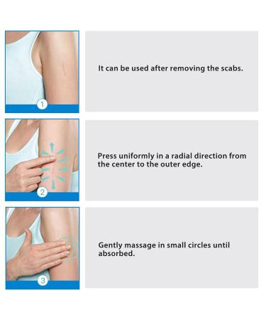 Scar Removal Ointment Gel - Herbal Cream for Old & New Scars, Stretch Marks, Surgery Injuries, Burns & Acne Treatment 1.1oz - Buy Online on GoSupps.com