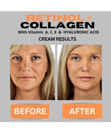 Retinol + Collagen Anti-Aging Face Cream - Hyaluronic Acid & Vitamin C | Day & Night Moisturizer - Firming Anti-Wrinkle Cream 4oz - Buy Online on GoSupps.com