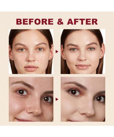 Fengyang 1988 Retinal Serum Retinal Liposome and Black Ginseng antiwrinkle facial serum for tight and radiant skin - Buy Online on GoSupps.com