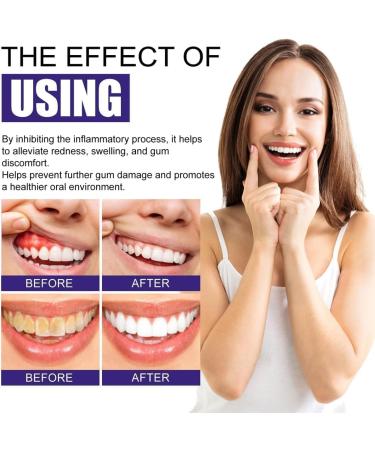 EXQST Gum Treatment Foam Gum Tissue Regeneration and Repair Deep Stain Cleaning Gum Treatment Foam Deeply Cleaning Gums Stain Removal Deep Stain Cleaning Gum Treatment Foam 1pcs - Buy Online on GoSupps.com