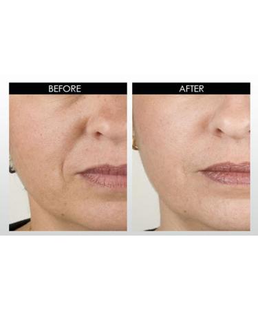 DNA Code - No Needle Alternative-Argireline NeuroPeptides Wrinkle Reduce Moisturizer+Matrixyl 3000 Syn-Ake SNAP-8 Copper Peptides 1 Fl Oz (Pack of 1) - Buy Online on GoSupps.com