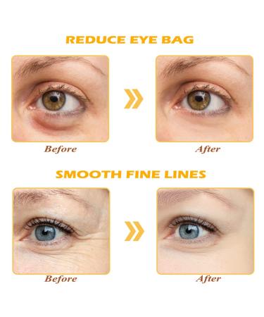 Devimic 24K Gold Eye Mask - 30 Pairs for Dark Circles and Puffiness | Under Eye Patches for Puffy Eyes and Eye Bags - Gel Eye Mask for Face Skin Care - Buy Online on GoSupps.com