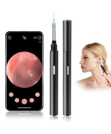 LOOYUAN Ear Wax Removal Endoscope Earwax Remover Tool Wireless Ear Otoscope Ear Camera with 6 LED Lights Ear Scope with Ear Wax Cleaner Tool Visual Ear Endoscope Kit for Kids Adults Android iOS