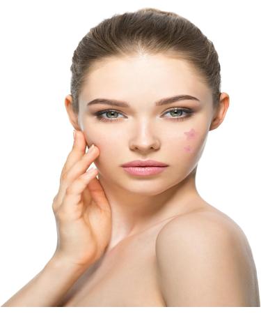 MUKBEC Acne Patch Pimple Patch 160 Pieces Acne Patches Dressing Cover Spot Stickers Spot Treatment - Buy Online on GoSupps.com