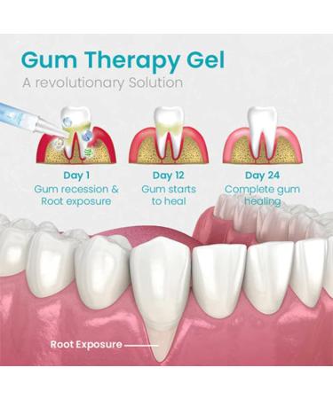 (Most Gifted) 5Pcs Gum Shield Therapy Gel - Neslemy Gum Gel | Aulrz Gum Therapy Gel for Recessed Gums | Teeth Whitening Essence Pen | Gum Repair Treatment Gel | Gum Instant Treatment Gel - 4ml/0.14fl.oz - Buy Online on GoSupps.com