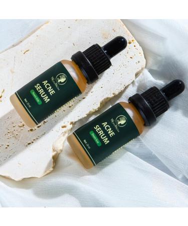 Buy Acne Serum (0.7 fl oz) | Fast International Shipping & Clear Skin Solution - Buy Online on GoSupps.com