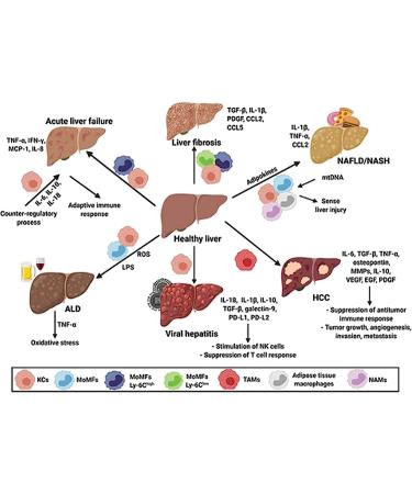 DENERASS TinaHerbs PRO Milk Thistle & Cordyceps Sinensis Drops - Liver Support Detox & Repair - Herbal Drops Trio - Buy Online on GoSupps.com