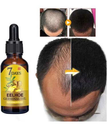 Enkomy Hair Growth Serum | 40ml Anti-Hair Loss Ginger Oil - Boost Hair Growth & Nourishment - Buy Online on GoSupps.com