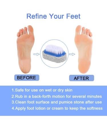 minkissy Sponge Pumice Stone Foot Remove Natural Sponge Pumice Pedicure Supplies Skin so Soft Nail Sponge Pedicure Tool feet Scrubber Dead Skin Multicolor Pedicure so - Buy Online on GoSupps.com