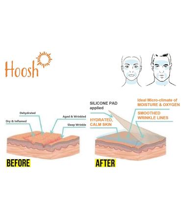 Hoosh Face Wrinkle Pads | 6 Pack Reusable Silicone Patches for Men & Women - Face Lift Mask for Neck, Forehead, Eyes, and Smile Lines Treatment - Buy Online on GoSupps.com