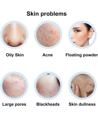 Oil Absorbing Roller Volcanic Rock Oil Oil Absorbing Face Roller Reusable Dual Heads Oil Control Volcanic Skin Roller for Face Makeup - Buy Online on GoSupps.com