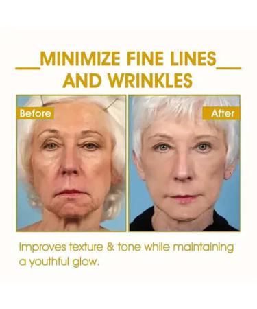 Buy Skinfirming Rejuvenating Oil | Firming & Hydrating Face & Body Oil for All Skin Types - Improve Elasticity & Reduce Wrinkles - Buy Online on GoSupps.com