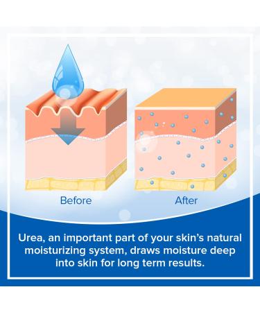 Dermal Therapy 2-in-1 Body Wash & Moisturizing Cleanser - 5% Urea AHA Sulfate-Free - 16 Fl Oz | International Shipping Available - Buy Online on GoSupps.com