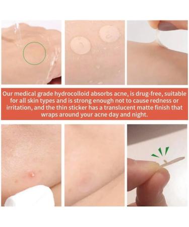 Acne Patches Pimple Patch Spot Treatment Stickers for Face and Body Fast-Acting Vegan & Cruelty Free Skin Care Blemishes Treating acne - Buy Online on GoSupps.com