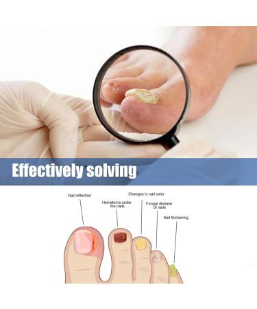 Fungal Nail Treatment - Extra Strong Nail Fungus Treatment for Toenail - Toenail Fungus Treatment for Thickening - Anti Fungus Nail Repair and Strengthen Fix Damaged - Buy Online on GoSupps.com