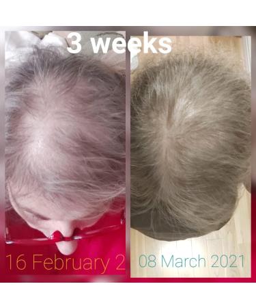 CRISAN Extreme Hair Strengthening Oil - 16 oz - 55 Organic Vegan Essential and Carrier Oils - Thicken Grow and Restore Hair for Shinier Healthier Locks - Buy Online on GoSupps.com