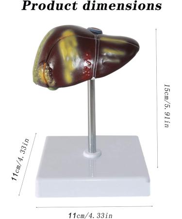 Liver Anatomy Model Human Liver Disease Model Liver Fat/Cirrhosis/Pathological Hepatobiliary Disease Model Medical Education and Training Auxiliary Human Organ Anatomical Model - Buy Online on GoSupps.com