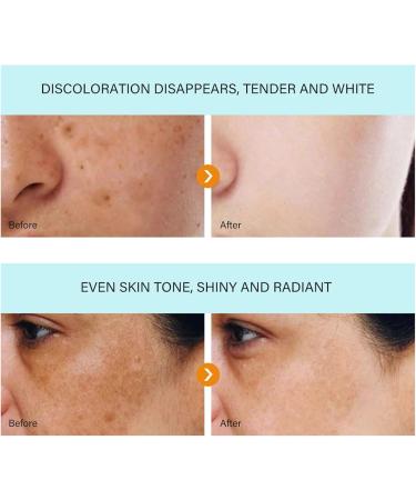Fade Stain Beauty Cream Skin Brightening Moisturizing Face Serum Skin Brightening Serum Collagen Boosting Serum Skin Repairing Serum Freckle Remover Cream Corrector Cream for Face and Body 30ML - Buy Online on GoSupps.com