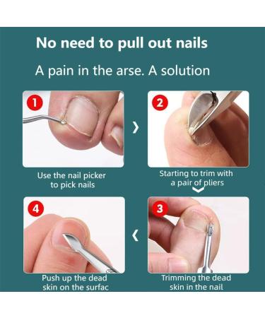 6-piece pedicure set for ingrown toenails ingrown long toenail treatment and thick nail clippers toenail corrector black set boxed set for inward growth of thick and hard toenail nails large toena - Buy Online on GoSupps.com