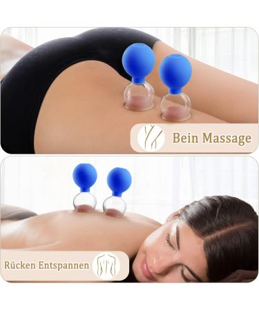 High-Quality Glass Cupping Set - 5 Piece Blue Cupping Glasses with TPU Suction for Relaxation & Wellness - Effective Fascia Scraping - Buy Online on GoSupps.com