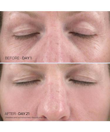 Dr. Pure Under Eye Patches - Retinol & Hyaluronic Acid Eye Mask for Puffiness Dark Circles & Wrinkles | 30 Pairs - Buy Online on GoSupps.com