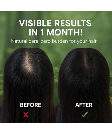 XKrmp Green Triangle Soap Shampoo Bar with Usman Grass Natural Cypress Leaf Solid Shampoo Bar for Natural Herbal Hair Care Calming & Strengthens Hair for Women and Men 2PCS - Buy Online on GoSupps.com