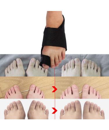 Bunion Corrector & Thumb Splint - Hallux Valgus Pain Relief Night & Day Support for Hammer Toe - Right Black - Buy Online on GoSupps.com