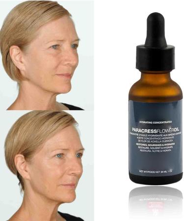 Paracress Facial Oil 30ml Paracress Oil Paracress Serum Paracress Facial Serum Organic Paracress Face Serum Paracress Extract Face Oil Reduce Fine Lines And Wrinkles for All Skin Types (1Pcs) 30 ml (Lot de 1) - Buy Online on GoSupps.com