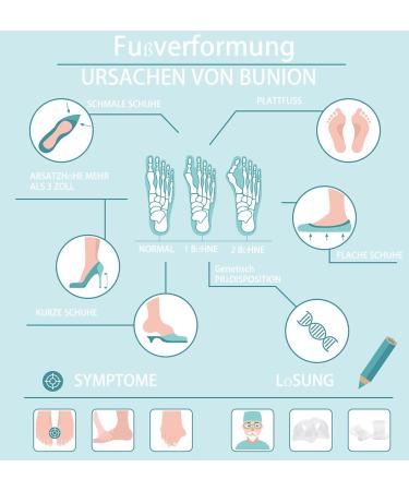 Toe Spreader for Correcting Overlapping Toes - 12 Large-Scale Toe Separator Spacers for Hallux Valgus Hammer Toes & Bunion Relief - Buy Online on GoSupps.com