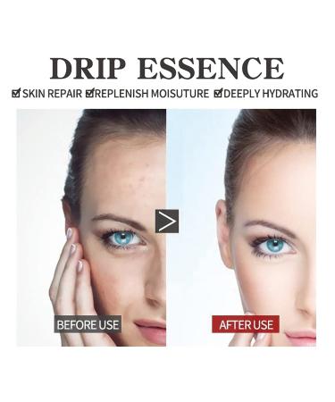 EELHOE 2Pcs Eternity Vita-min C & Collagen Boost Serum Set - Anti Aging, Dark Spot Corrector for Daily Face Care - Buy Online on GoSupps.com